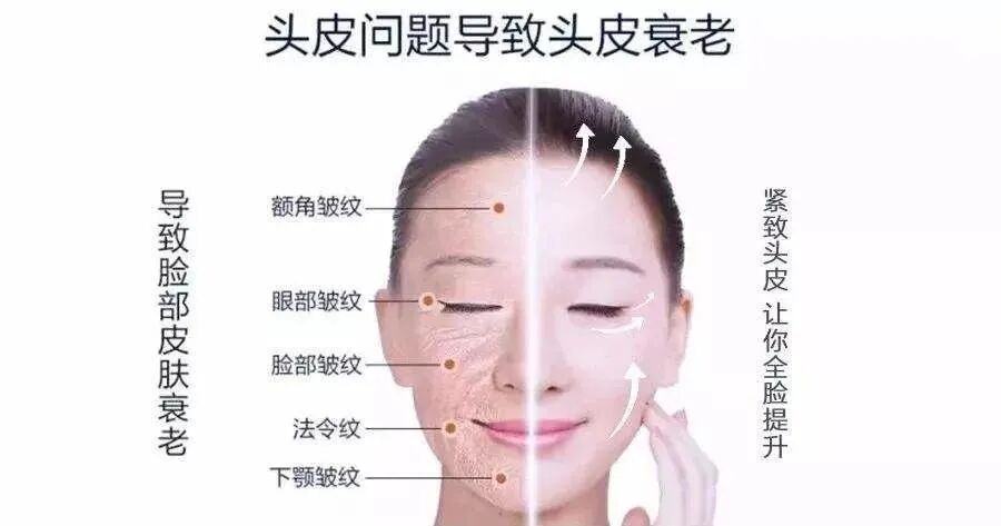 你不可忽略的头皮保养和维护