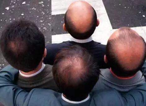 重塑头皮健康，最好的方式就是从头皮养护开始。