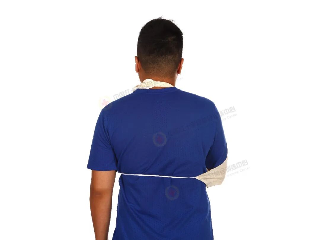 医用绷带怎么绑图解应急救护科普 ｜ 现场包扎技术之三角巾悬臂带_https://www.jmylbn.com_新闻资讯_第7张