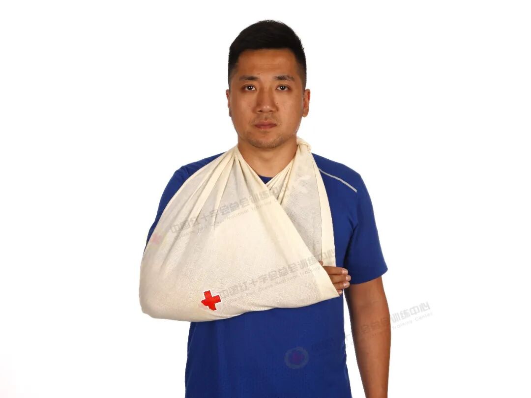 医用绷带怎么绑图解应急救护科普 ｜ 现场包扎技术之三角巾悬臂带_https://www.jmylbn.com_新闻资讯_第8张