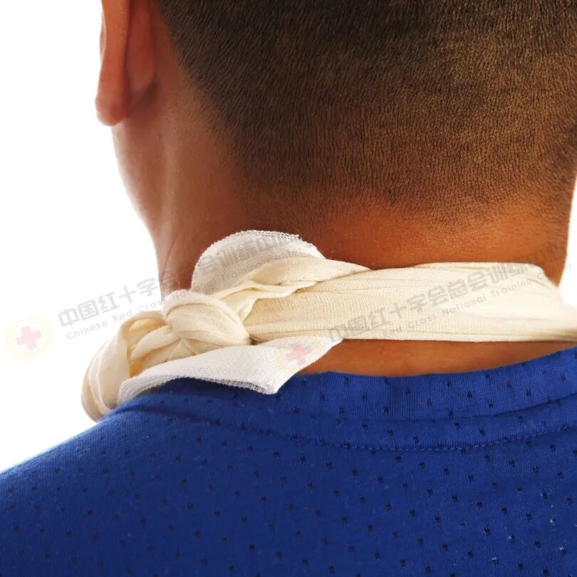 医用绷带怎么绑图解应急救护科普 ｜ 现场包扎技术之三角巾悬臂带_https://www.jmylbn.com_新闻资讯_第4张