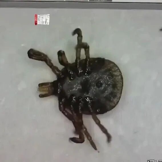 外科胶带怎么撕暑假到了，耳鼻喉科和泌尿外科又要掀起一轮手术狂潮！腺样体／扁桃体切除手术，你家孩子真的需要做吗？_https://www.jmylbn.com_新闻资讯_第42张