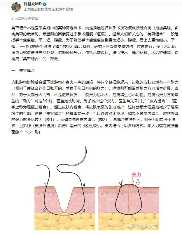医用凡士林敷料怎么用6岁女童在小区摸了下竹子，手掌被扎了200根刺！孩子的妈妈用各种“偏方”拔刺：醋泡、用瓶子吸、针挑、胶布粘……手掌差点报废_https://www.jmylbn.com_新闻资讯_第17张