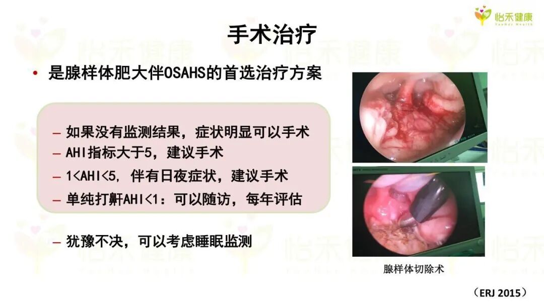 外科胶带怎么撕暑假到了，耳鼻喉科和泌尿外科又要掀起一轮手术狂潮！腺样体／扁桃体切除手术，你家孩子真的需要做吗？_https://www.jmylbn.com_新闻资讯_第27张