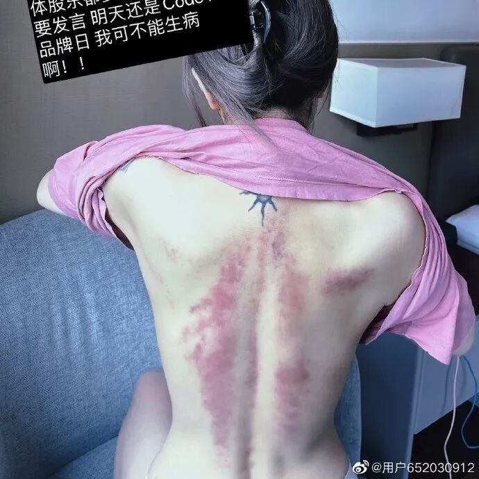 外科胶带怎么撕暑假到了，耳鼻喉科和泌尿外科又要掀起一轮手术狂潮！腺样体／扁桃体切除手术，你家孩子真的需要做吗？_https://www.jmylbn.com_新闻资讯_第44张