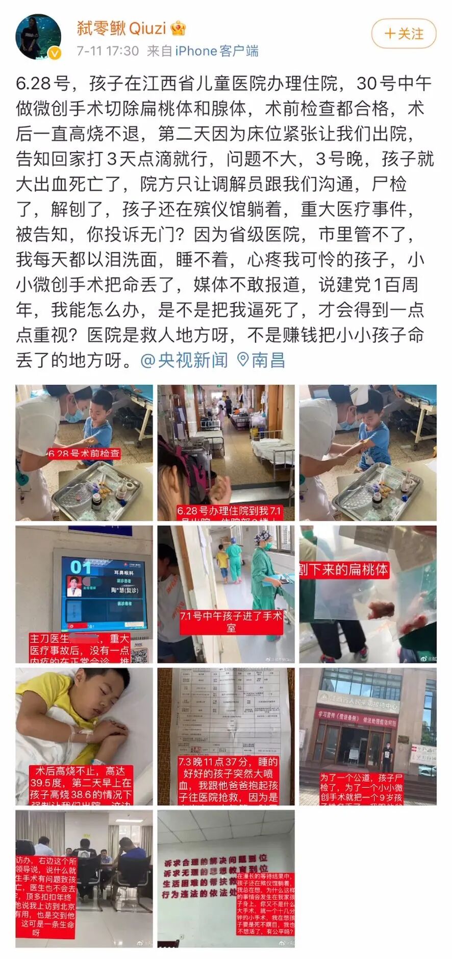 外科胶带怎么撕暑假到了，耳鼻喉科和泌尿外科又要掀起一轮手术狂潮！腺样体／扁桃体切除手术，你家孩子真的需要做吗？_https://www.jmylbn.com_新闻资讯_第35张