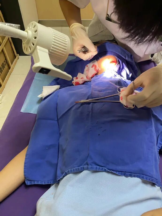 医用凡士林敷料怎么用6岁女童在小区摸了下竹子，手掌被扎了200根刺！孩子的妈妈用各种“偏方”拔刺：醋泡、用瓶子吸、针挑、胶布粘……手掌差点报废_https://www.jmylbn.com_新闻资讯_第32张