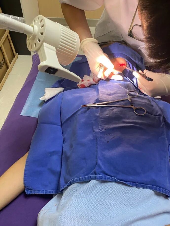 医用凡士林敷料怎么用6岁女童在小区摸了下竹子，手掌被扎了200根刺！孩子的妈妈用各种“偏方”拔刺：醋泡、用瓶子吸、针挑、胶布粘……手掌差点报废_https://www.jmylbn.com_新闻资讯_第31张