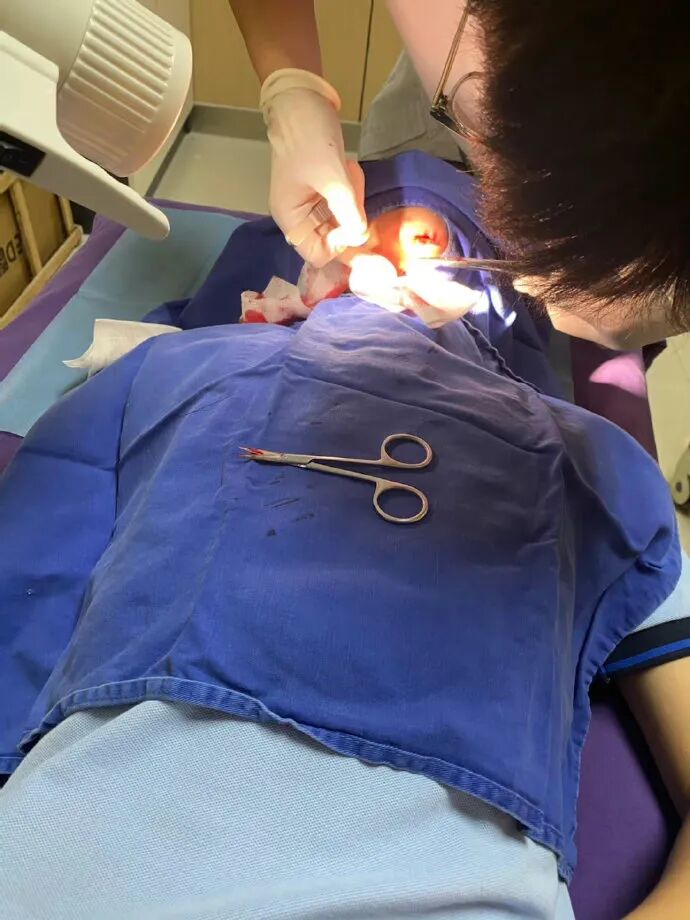 医用凡士林敷料怎么用6岁女童在小区摸了下竹子，手掌被扎了200根刺！孩子的妈妈用各种“偏方”拔刺：醋泡、用瓶子吸、针挑、胶布粘……手掌差点报废_https://www.jmylbn.com_新闻资讯_第27张