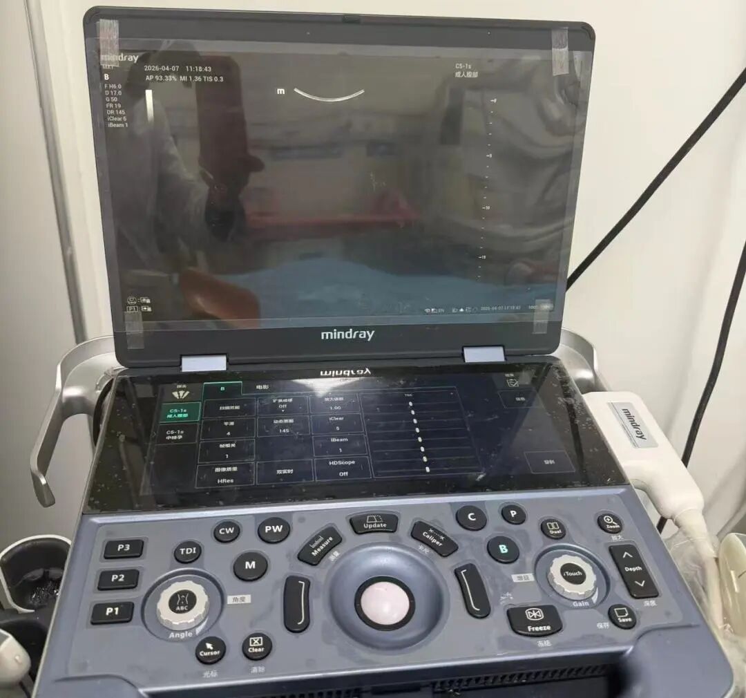 妇科产床怎么用【科室简介】察雅县人民医院妇产科——守护妇幼健康，市级重点专科为您保驾护航_https://www.jmylbn.com_新闻资讯_第17张