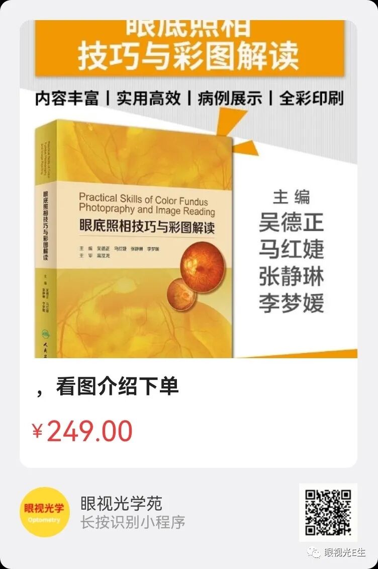 彩色眼底照相查什么一张眼底照片，可筛查出80%的眼病_https://www.jmylbn.com_新闻资讯_第14张