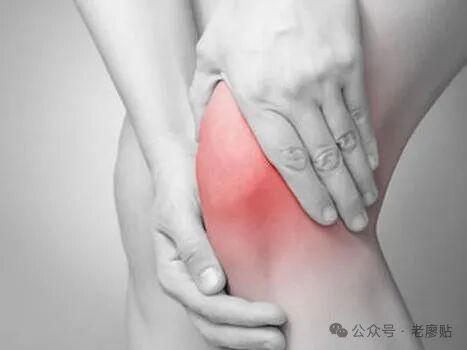 滑膜炎少量积液：科学应对，精准治疗的康复之路