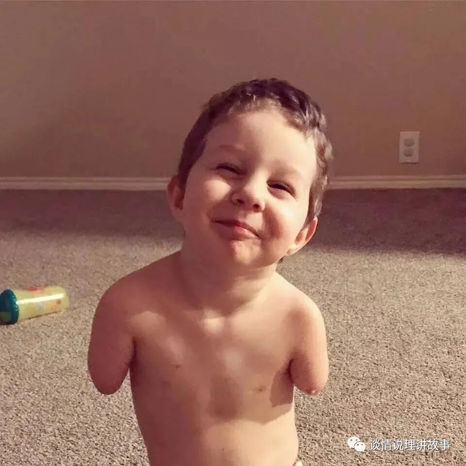 圣诞节特辑 明知孩子无四肢 18岁妈妈仍冒险生下他 8年后这个孩子怎样了 热点讯息网