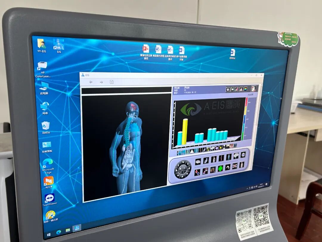 法国鹰演怎么查无创无辐射！我院引入法国进口A·EIS全身检测系统_https://www.jmylbn.com_新闻资讯_第6张
