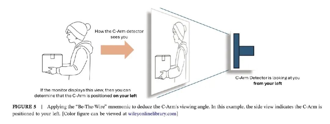 造影导丝是什么如何用“化身导丝”的理念去理解和实现 IVUS-造影配准？_https://www.jmylbn.com_新闻资讯_第10张