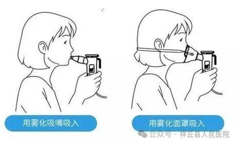 怎么用雾化器成人雾化吸入的方法及注意事项_https://www.jmylbn.com_新闻资讯_第3张