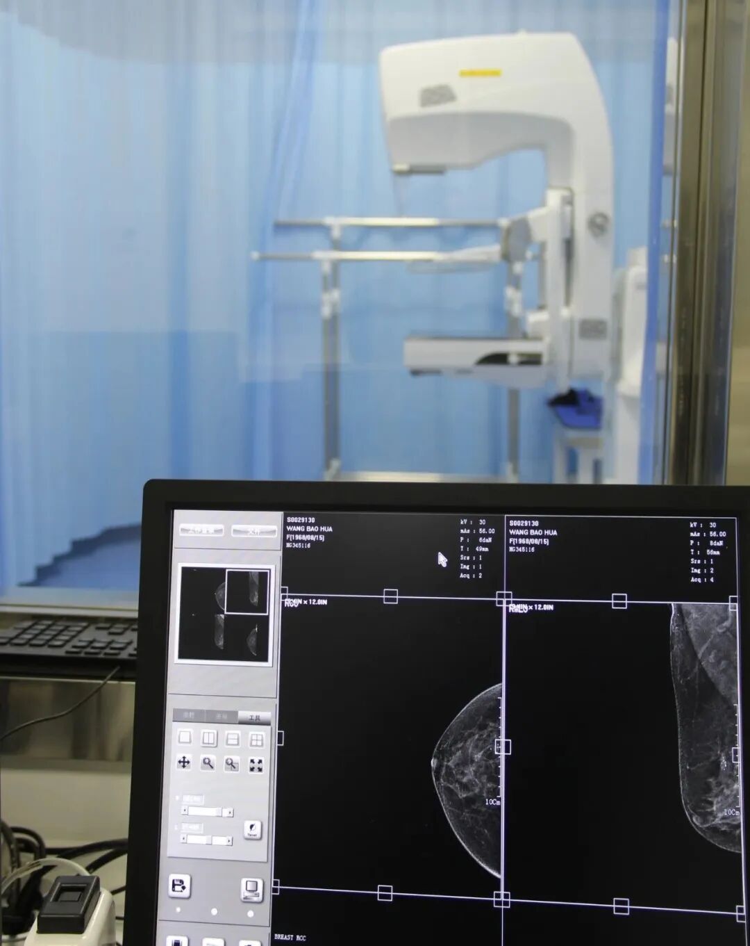 【健康科普】为女性朋友尽早"排雷"——钼靶检查