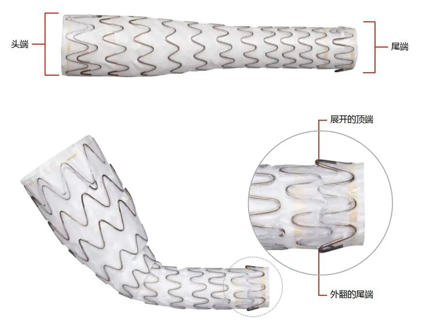 gore医疗怎么样「胸有乾坤」千钧一发 转危为安——Gore TBE治疗急诊破裂TAA一例_https://www.jmylbn.com_新闻资讯_第25张