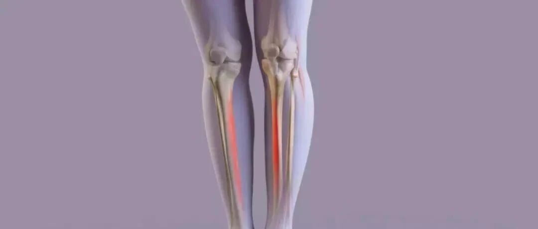 一起了解下我们的膝关节是怎样组成的