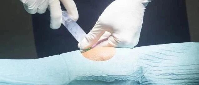 膝盖不好可以打玻璃酸钠吗？有效果吗？