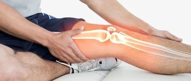 我的膝盖怎么了？——膝关节不同部位疼痛的原因