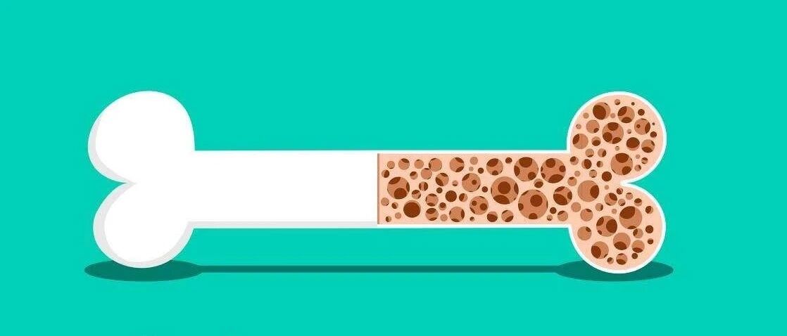 大西游 话骨松—了解“沉默的杀手”骨质疏松症