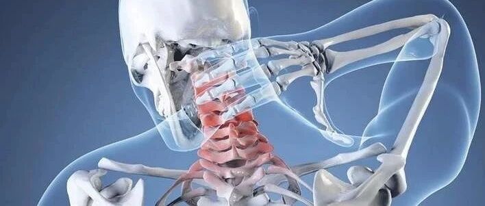 颈椎病分10级，超过2级就要注意了!一分钟自测试你到达了第几级