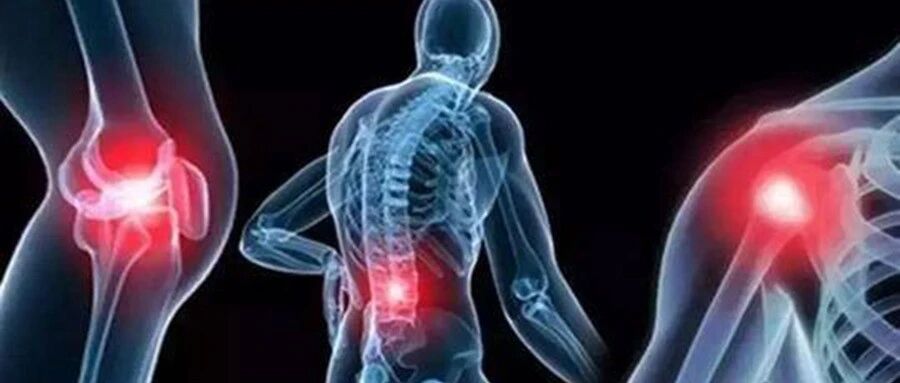 世界关节炎日：北京协和医院专家带您一起了解骨关节炎