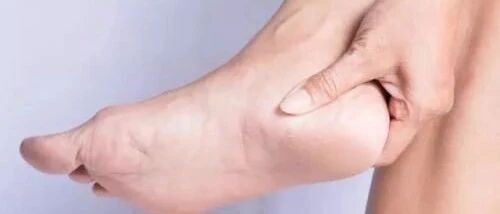 足跟疼痛难忍？别着急！这些简单应对方法，超管用！