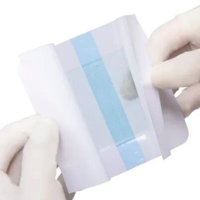 水凝胶伤口敷料怎么用伤口愈合，水凝胶来帮你_https://www.jmylbn.com_新闻资讯_第1张