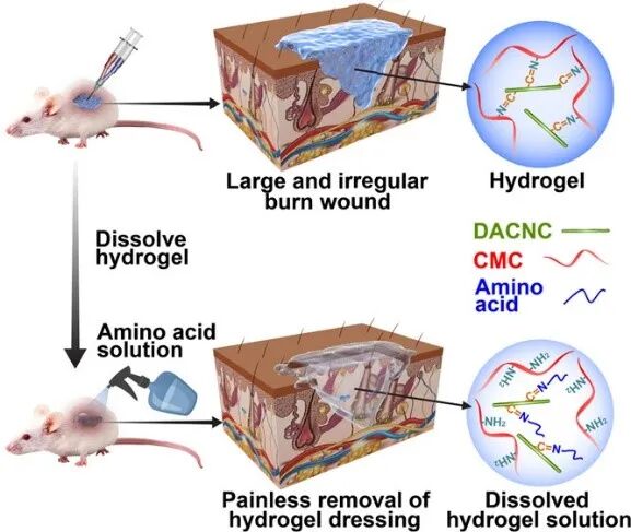 水凝胶伤口敷料怎么用伤口愈合，水凝胶来帮你_https://www.jmylbn.com_新闻资讯_第17张