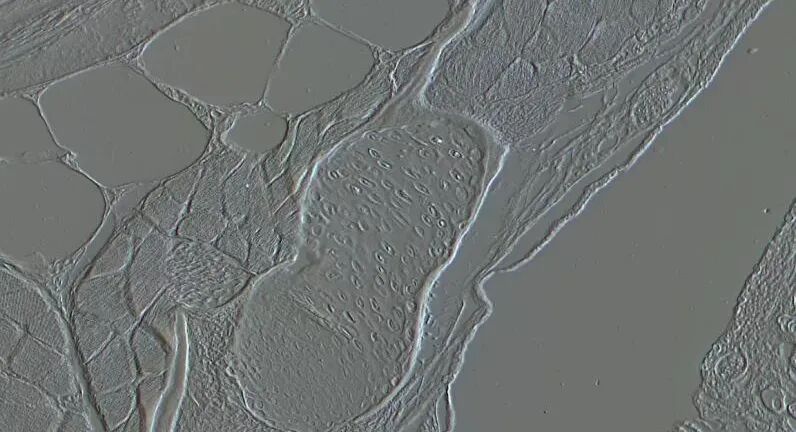 一文速览：显微镜常见的7种观察方式