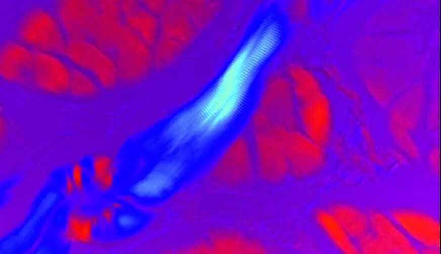 一文速览：显微镜常见的7种观察方式