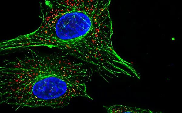 一文速览：显微镜常见的7种观察方式
