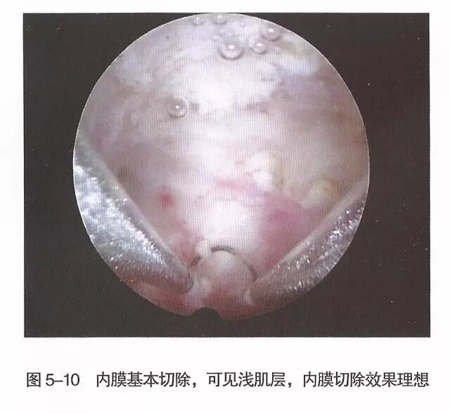 宫腔镜器械怎么组装【宫腔镜篇】器械简介_https://www.jmylbn.com_新闻资讯_第16张