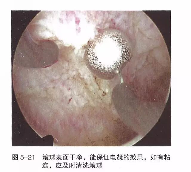 宫腔镜器械怎么组装【宫腔镜篇】器械简介_https://www.jmylbn.com_新闻资讯_第29张