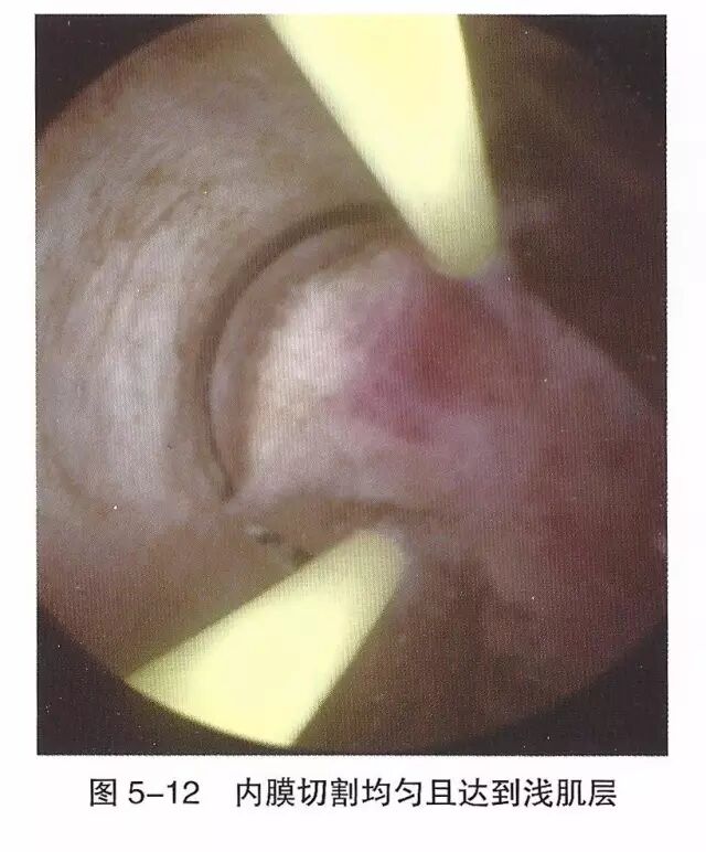 宫腔镜器械怎么组装【宫腔镜篇】器械简介_https://www.jmylbn.com_新闻资讯_第18张