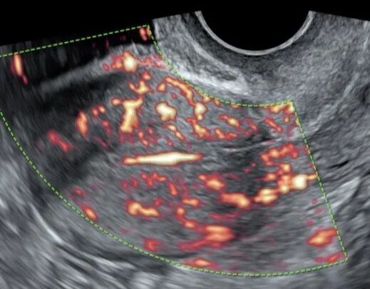 VOlusonE什么彩超机世界顶级四维彩超机美国 GE Voluson E10 BT20金标版落户吉林省吉林中西医结合医院_https://www.jmylbn.com_新闻资讯_第9张