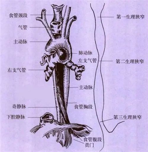 食管三处狭窄图片