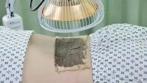 烫熨治疗贴怎么用【慈利县中医医院妇产科】中医特色治疗，呵护女性健康_https://www.jmylbn.com_新闻资讯_第6张