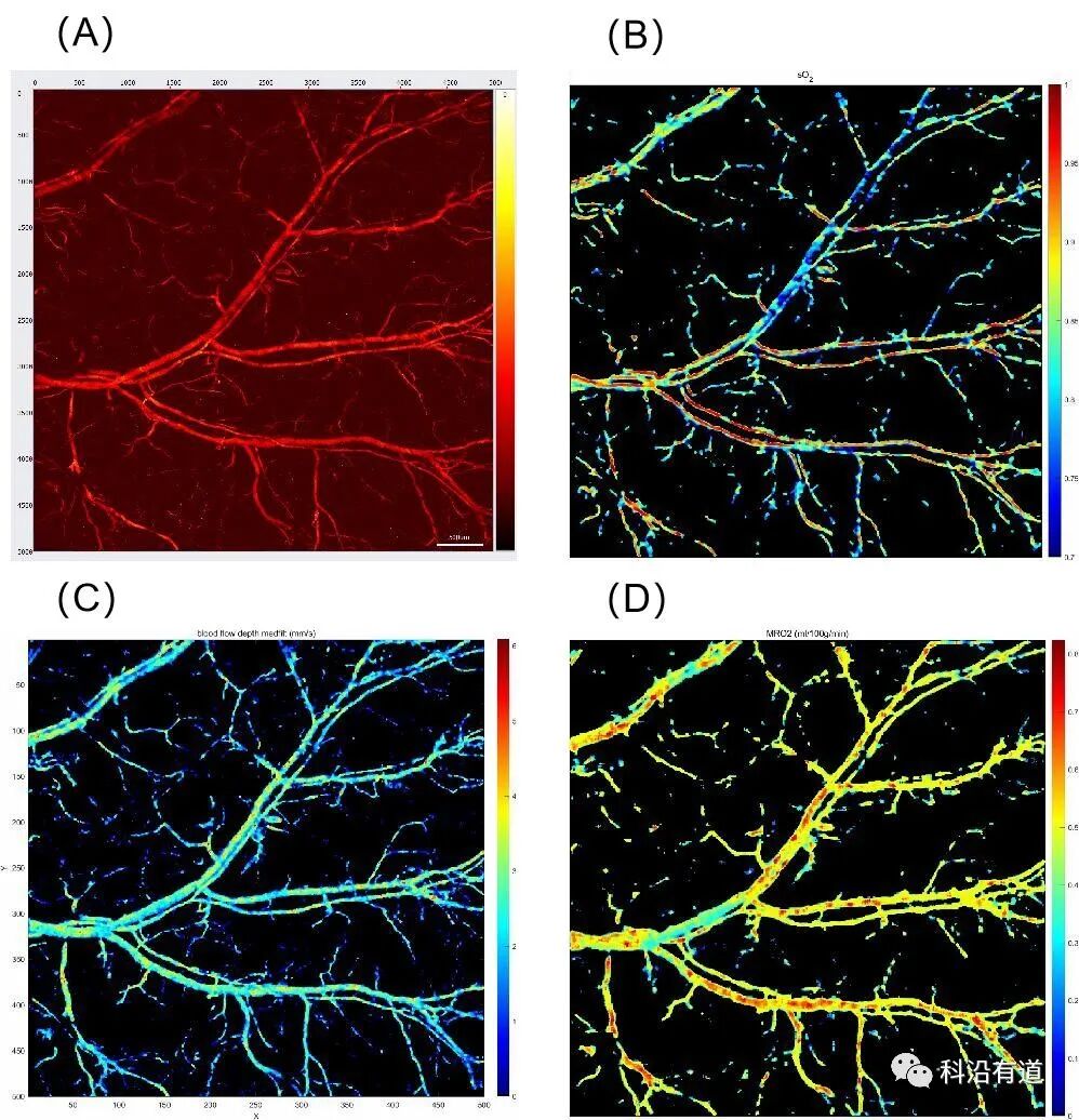 光声成像-耳成像简介