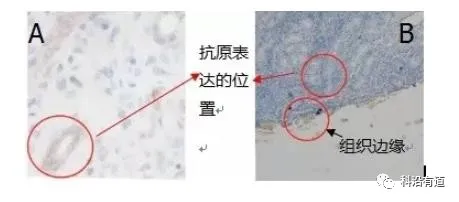 免疫组化IHC常见问题与解决方案