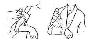 为什么手术后要经常翻身骨科常见疾病术后体位及注意事项_https://www.jmylbn.com_新闻资讯_第5张