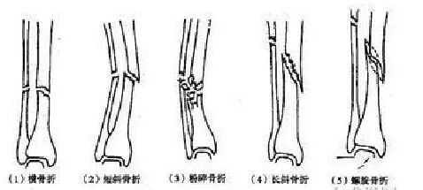 为什么手术后要经常翻身骨科常见疾病术后体位及注意事项_https://www.jmylbn.com_新闻资讯_第11张