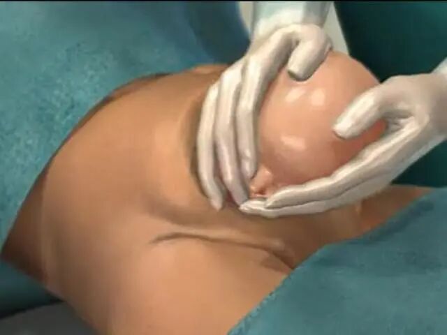 产包有什么器械剖腹产只需打一针就好了？看看这场手术的器械和步骤，不寒而栗_https://www.jmylbn.com_新闻资讯_第6张