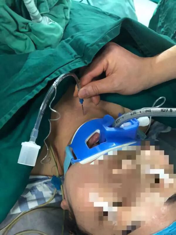 ue可视喉镜怎么购买美容麻醉手册第八季：医美困难气道(陈勇)_https://www.jmylbn.com_新闻资讯_第11张