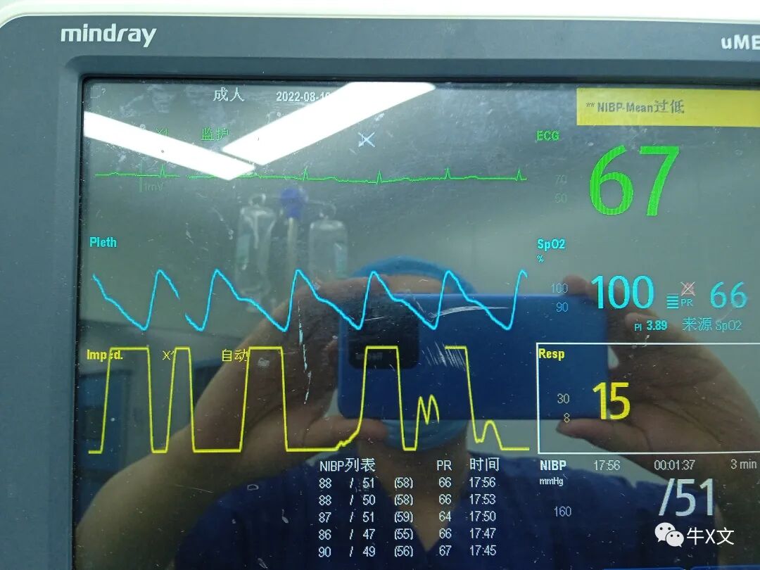 什么是呼吸麻醉整形院长命丧手术台：究竟什么原因？如何避免？正确的处理方法是什么？_https://www.jmylbn.com_新闻资讯_第9张