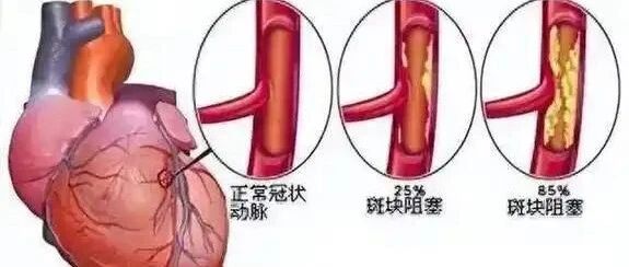 cover_image