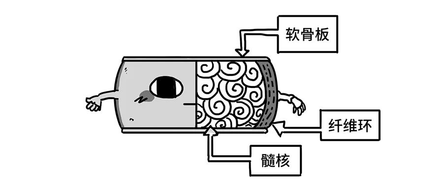 【注意】腰椎間盤突出，就像婆媳矛盾，3 招幫你解決 健康 第3張