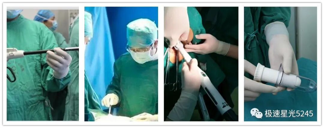 吻合器怎么用吻合器的种类及应用_https://www.jmylbn.com_新闻资讯_第2张